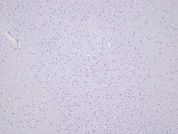 Novus Biologicals Brain Temporal Lobe Tissue Slides (Multiple Sclerosis)- Paraffin 5 Slides | Buy Online | Novus Biologicals&trade; | Fisher Scientific