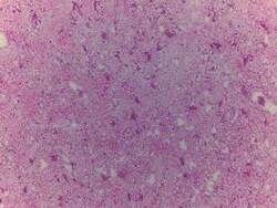 Novus Biologicals Brain Thalamus Tissue Slides (Adult Normal)- Frozen 5 Slides | Buy Online | Novus Biologicals&trade; | Fisher Scientific