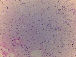 Novus Biologicals&trade;&nbsp;Brain Thalamus Tissue Slides (Multiple Sclerosis)- Frozen