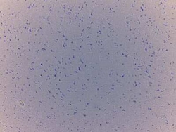 Novus Biologicals&trade;&nbsp;Brain Tissue Slides (Adult Normal)- Paraffin