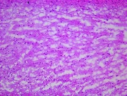 Novus Biologicals Brain Tissue Slides (Alzheimer's)- Frozen 5 Slides | Buy Online | Novus Biologicals&trade; | Fisher Scientific