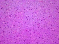 Novus Biologicals&trade;&nbsp;Brain Tissue Slides (Multiple Sclerosis)- Frozen