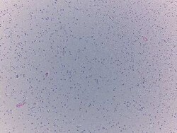 Novus Biologicals&trade;&nbsp;Brain Tissue Slides (Multiple Sclerosis)- Paraffin