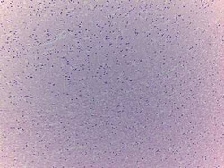 Novus Biologicals&trade;&nbsp;Brain Tissue Slides (Parkinson's)- Paraffin