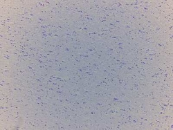 Novus Biologicals Brain Tuberculum Cinereum Tissue Slides (Adult Normal)- Paraffin 5 Slides | Buy Online | Novus Biologicals&trade; | Fisher Scientific