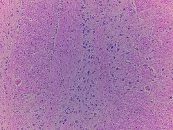 Novus Biologicals Brain Vermis Cerebelli Tissue Slides (Adult Normal)- Paraffin 5 Objektträger | Buy Online | Novus Biologicals&trade; | Fisher Scientific