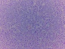 Novus Biologicals Breast Matched Tumor and Normal Tissue Slides (Tumor)- Paraffin 10 Slides | Buy Online | Novus Biologicals&trade; | Fisher Scientific