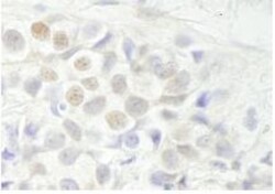 Breast carcinoma amplified sequence 3 Antibody, Novus Biologicals 0.1mL;