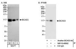 Breast carcinoma amplified sequence 3 Antibody, Novus Biologicals 0.1mL;