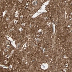 Brevican Antibody, Novus Biologicals:Antibodies:Primary Antibodies
