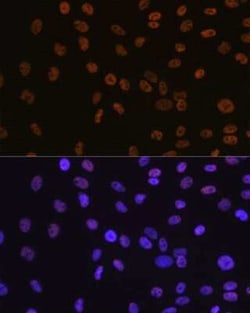 Brg1 Rabbit anti-Human, Mouse, Rat, Clone: 4N9C4, Novus Biologicals 20