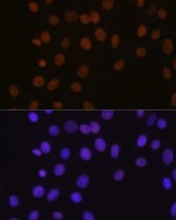 Brg1 Rabbit anti-Human, Mouse, Rat, Clone: 4N9C4, Novus Biologicals 20