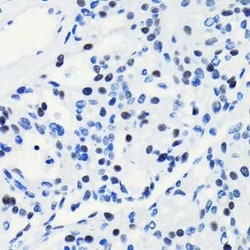 Brg1 Rabbit anti-Human, Mouse, Rat, Clone: 4N9C4, Novus Biologicals 20