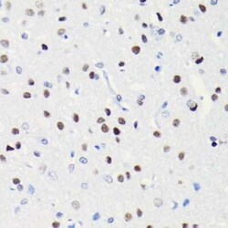 Brg1 Rabbit anti-Human, Mouse, Rat, Clone: 4N9C4, Novus Biologicals 20