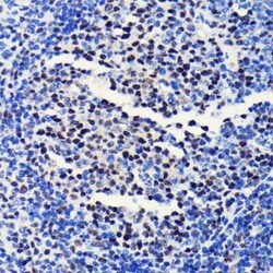 Brg1 Rabbit anti-Human, Mouse, Rat, Clone: 4N9C4, Novus Biologicals 20