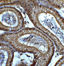 Brg1 Antibody - BSA Free, Novus Biologicals:Antibodies:Primary Antibodies