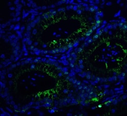 Brg1 Antibody - BSA Free, Novus Biologicals:Antibodies:Primary Antibodies