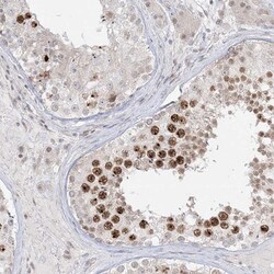 Brk Antibody, Novus Biologicals 25 &mu;L; Unlabeled:Antibodies, Polyclonal