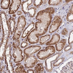 Buster3 Antibody, Novus Biologicals 25 &mu;L | Buy Online | Novus Biologicals | Fisher Scientific