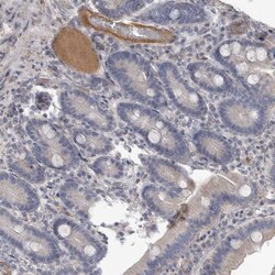 C-Reactive Protein/CRP Antibody, Novus Biologicals:Antibodies:Primary Antibodies