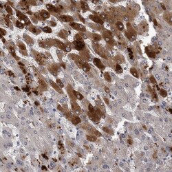 C-Reactive Protein/CRP Antibody, Novus Biologicals:Antibodies:Primary Antibodies