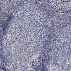 C-Reactive Protein/CRP Antibody, Novus Biologicals:Antibodies:Primary Antibodies