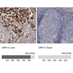 C-Reactive Protein/CRP Antibody, Novus Biologicals:Antibodies:Primary Antibodies