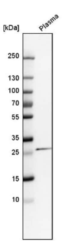 C-Reactive Protein/CRP Antibody, Novus Biologicals:Antibodies:Primary Antibodies