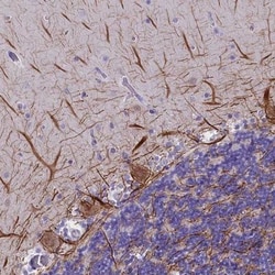 SKIDA1 Antibody, Novus Biologicals 0.1mL; Unlabeled:Antibodies, Polyclonal
