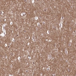 FAM241B Antibody, Novus Biologicals 25 &mu;L; Unlabeled:Antibodies, Polyclonal