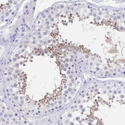 C10orf53 Antibody, Novus Biologicals 0.1 mL | Buy Online | Novus Biologicals | Fisher Scientific