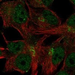 C11orf24 Rabbit anti-Human, Polyclonal, Novus Biologicals 100 &mu;g | Buy Online | Novus Biologicals | Fisher Scientific