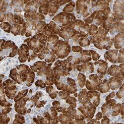 C11orf24 Antibody, Novus Biologicals 0.1mL; Unlabeled:Antibodies, Polyclonal