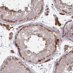 LMNTD2 Antibody, Novus Biologicals 25 &mu;L | Buy Online | Novus Biologicals | Fisher Scientific