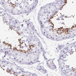 C11orf42 Antibody, Novus Biologicals 0.1mL; Unlabeled:Antibodies, Polyclonal