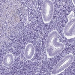 C11orf42 Antibody, Novus Biologicals 0.1mL; Unlabeled:Antibodies, Polyclonal