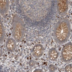 LBHD1 Antibody, Novus Biologicals 0.1mL; Unlabeled:Antibodies, Polyclonal