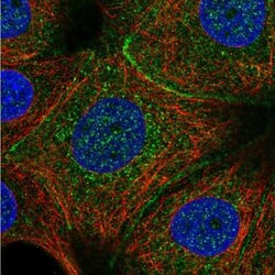 C11orf52 Antibody, Novus Biologicals 0.1mL; Unlabeled:Antibodies, Polyclonal