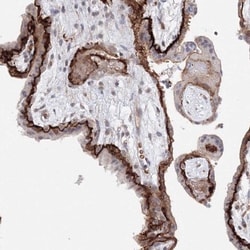 C11orf52 Antibody, Novus Biologicals 0.1mL; Unlabeled:Antibodies, Polyclonal