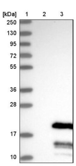 C11orf52 Antibody, Novus Biologicals 0.1mL; Unlabeled:Antibodies, Polyclonal