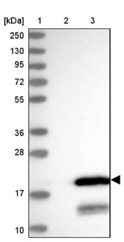 C11orf52 Antibody, Novus Biologicals 25 &mu;L | Buy Online | Novus Biologicals | Fisher Scientific