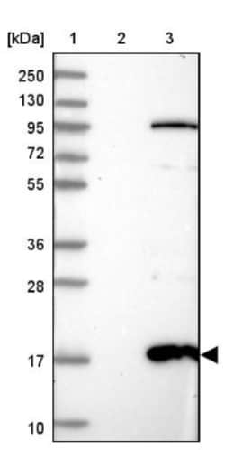 AAMDC Antibody, Novus Biologicals 25 &mu;L, Unlabeled:Antibodies, Polyclonal