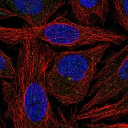 CFAP300 Antibody, Novus Biologicals 0.1mL; Unlabeled:Antibodies, Polyclonal