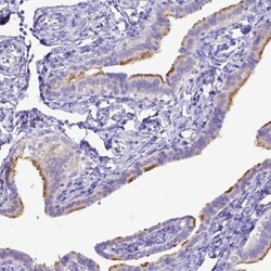 CFAP300 Antibody, Novus Biologicals 0.1mL; Unlabeled:Antibodies, Polyclonal