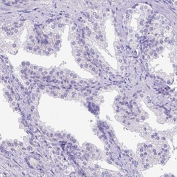 CFAP300 Antibody, Novus Biologicals 0.1mL; Unlabeled:Antibodies, Polyclonal