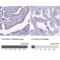 CFAP300 Antibody, Novus Biologicals 0.1mL; Unlabeled:Antibodies, Polyclonal