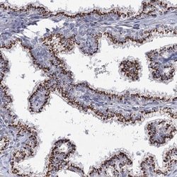 C11orf96 Antibody, Novus Biologicals 0.1mL; Unlabeled:Antibodies, Polyclonal