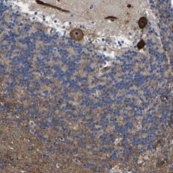 RESF1 Antibody, Novus Biologicals 0.1mL; Unlabeled:Antibodies, Polyclonal