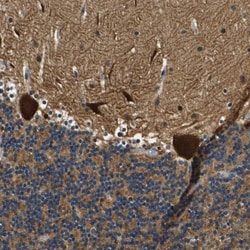 RESF1 Antibody, Novus Biologicals 25 &mu;L; Unlabeled:Antibodies, Polyclonal