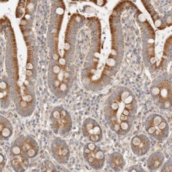 C12orf49 Antibody, Novus Biologicals 25 &mu;L | Buy Online | Novus Biologicals | Fisher Scientific